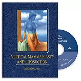 Best Breast Reduction Surgery book