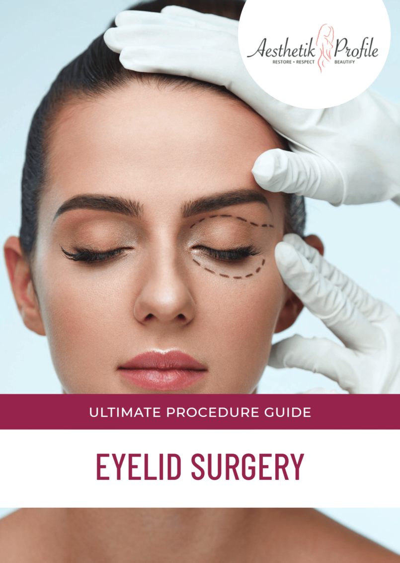 Guide Blepharoplasty