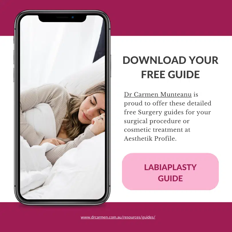 Guide Labiaplasty