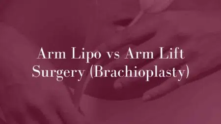 Arm-Lipo-vs-Arm-Lift-Surgery-(Brachioplasty)