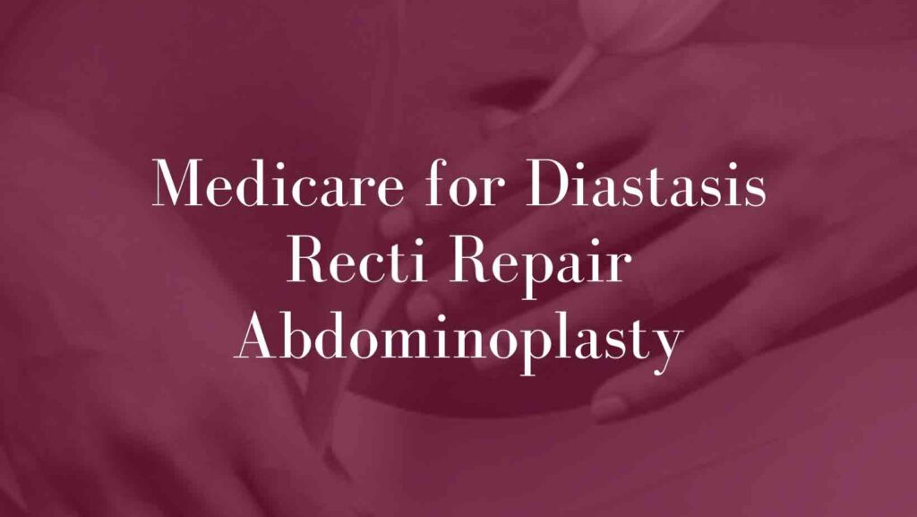 Medicare-for-Diastasis-Recti-Repair-Abdominoplasty