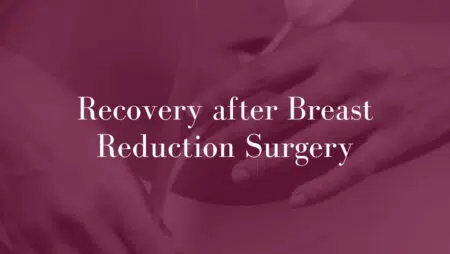 Recovery-after-Breast-Reduction-Surgery