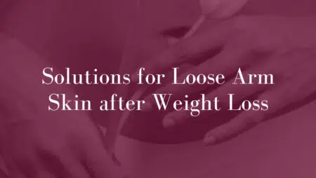 Solutions-for-Loose-Arm-Skin-after-Weight-Loss