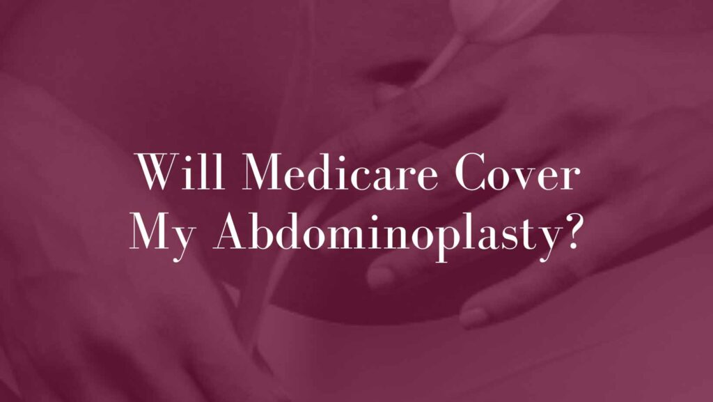 Will-Medicare-Cover-My-Abdominoplasty