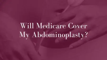 Will-Medicare-Cover-My-Abdominoplasty